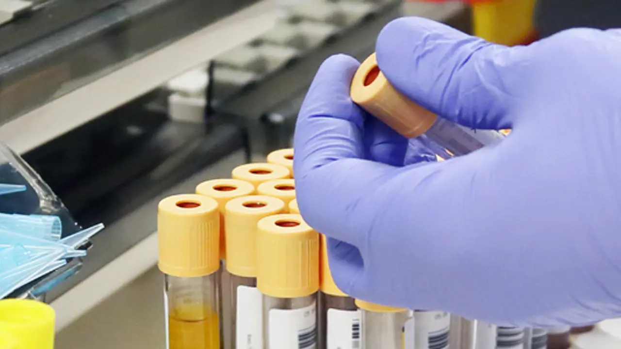 Government tries to introduce drug testing policy